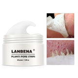 Tratamiento peeling puntos negros nariz